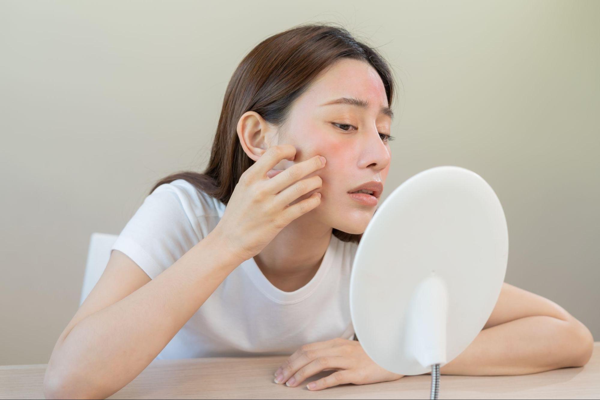 Unintentional Habits That Can Cause Acne